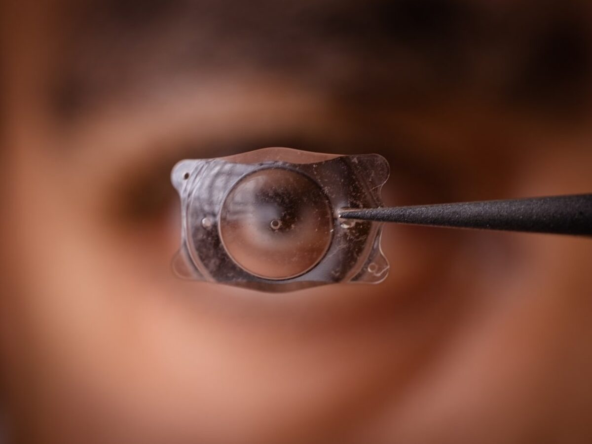 ICL Implant procedure